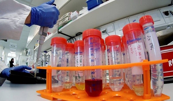 Απεργούν τα μικροβιολογικά εργαστήρια λόγω clawback